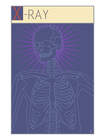 X-Ray