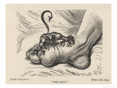 Little Devil Sinks His Teeth into the Swollen Foot of a Gout Sufferer