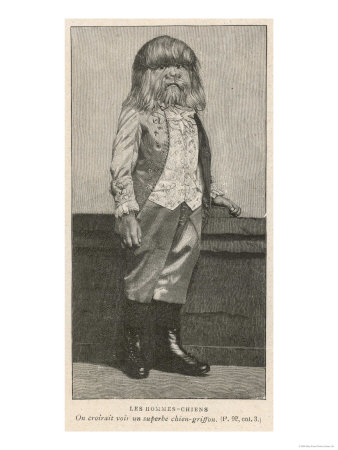 Young Polish Boy Exhibited at Berlin: Hairy Over Most of His Body But Normal in All Other Respects