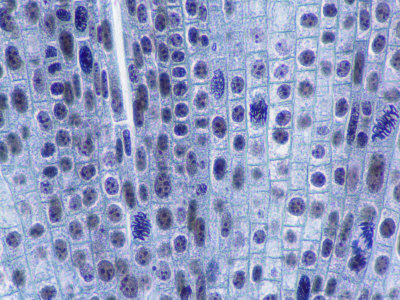 Mitosis in Onion Root Tip Cells