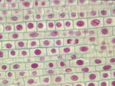 Onion Skin Mitosis X100