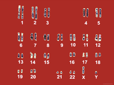 Normal Human Karyotype Chromosomes in Pairs