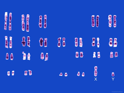 Normal Male Karyotype Paired Chromosomes