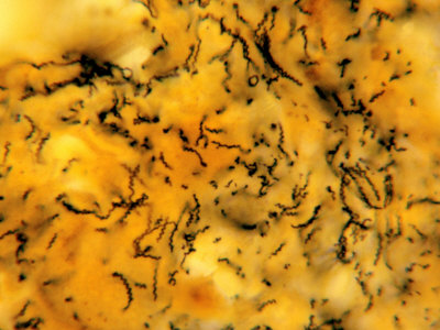 Treponema Pallidum Bacteria in Tissue, the Pathogen That Causes Syphilis