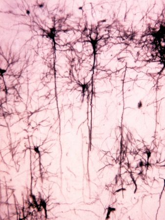 Neurons of the Cerebral Cortex Showing the Dendrites, Cell Bodies, and Axons