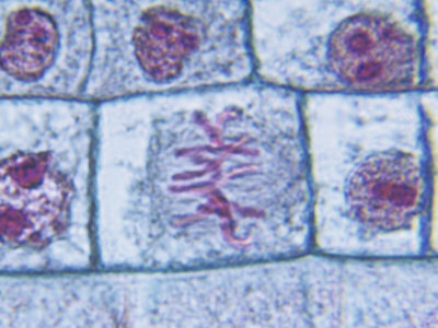 Metaphase Stage of Onion Mitosis (Allium)
