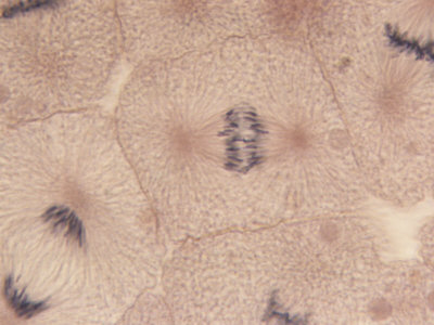Anaphase Stage