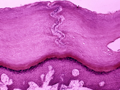 Human Skin Sweat Pore Showing Dead Epithelial Cells Above the Living Tissue