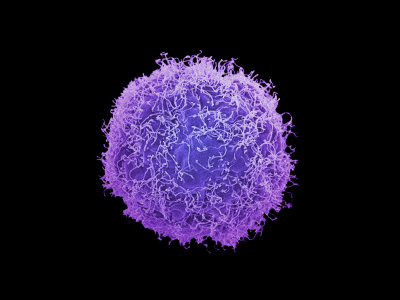 Human Skin Cancer Cell, Electron Microscopy Unit, Cancer Research, UK