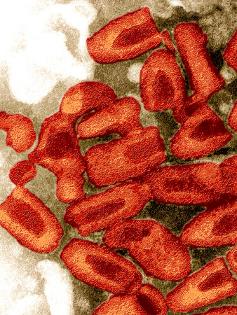 Rabies Viruses Showing their Characteristic Bullet Shape