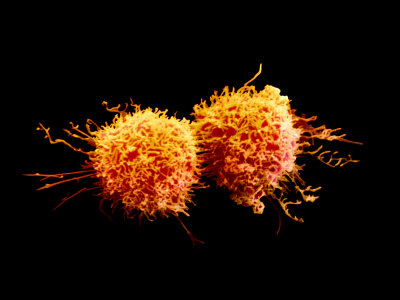 Cancer Cells Dividing