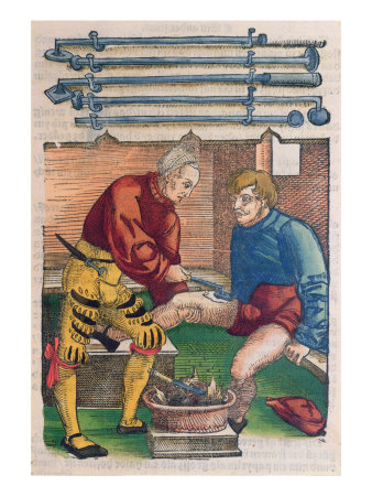 Cauterisation, Illustration from