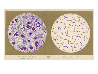 Bacillus of Bubonic Plague - Smear and Culture : Discovered by Yersin at Hong- Kong, 1894