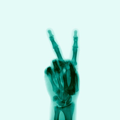 Buy X-Ray of Hand Doing Peace Sign at AllPosters.com