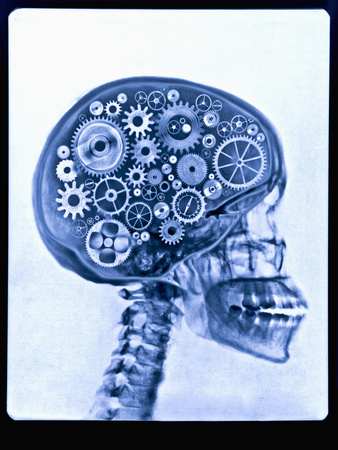 X-ray of skull with gears
