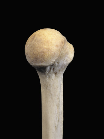 Upper Limb Bone, Left Humerus Proximal End, Lateral Lip of Intertubular Groove Medial Side