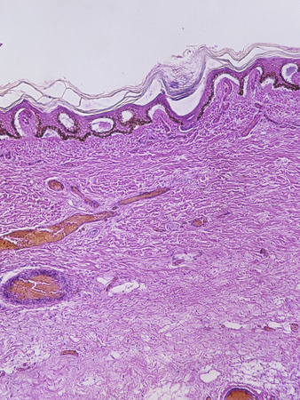 the edge of the cross-section looks like pink waves with a few red cells among the majority pink cells