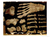 Anatomical Drawing of the Bones of the Foot