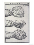 Detailed Views of a Roman Cestus a Leather Glove Used in Ancient Boxing