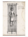 Buy Apparatus Intended to Correct Bow Legs at AllPosters.com