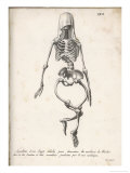 Buy Skeleton of an Adult Patient Afflicted with Rickets at AllPosters.com