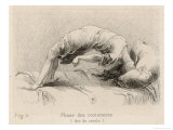 Buy Mental Patient at la Salpetriere Going Through the Phase of Contortions at AllPosters.com
