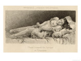 Buy Mental Patient at la Salpetriere in Phase of Tonic Immobility at AllPosters.com
