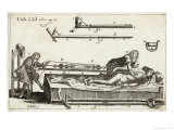 Buy Surgeons Setting a Bone with the Help of Michault's Bone- Setting Apparatus at AllPosters.com