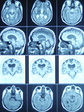 Buy Cat Scan Images of Brain at AllPosters.com