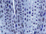 Mitosis in Onion Root Tip Cells