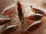 View of Body Lice Feeding on a Human Wrist