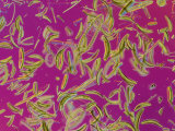 Diatoms