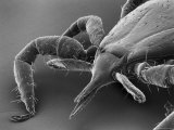 Deer Tick Magnified about 90 Times