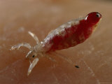 Buy Body Louse Taking a Blood Meal from a Person at AllPosters.com