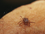 Grass or Bull Dog Tick on a Human Arm