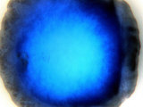 Buy Mycobacterium Xenopi at AllPosters.com