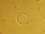 Buy Nematode Trapping Fungus at AllPosters.com