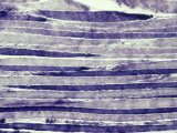 Buy Normal Human Skeletal Muscle at AllPosters.com