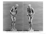 Buy Statuette of an Old Woman with Parkinson's Disease, After 1895 at AllPosters.com