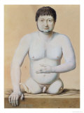 Man with a Genetic Deformity, 1812