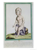 Buy Child with a Deformed Head, from Les Ecarts de La Nature, Paris, 1775 at AllPosters.com