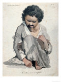 Total Cretinism, from a Book by Baron Jean Louis Alibert