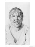Buy Cretin, Front View, Illustration from an Unpublished Treatise by Jean Etienne Dominique Esquirol at AllPosters.com