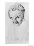 Idiot, Illustration from an Unpublished Treatise by Jean Etienne Dominique Esquirol