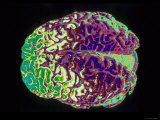 Buy Human Brain Colorized at AllPosters.com