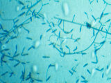Helminthosporum Parasitic Infection