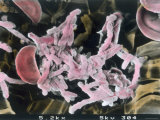 Buy Fibrin Strands Red Blood Cell, X5,200 at AllPosters.com