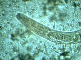 Photomicrograph Hookworm Larval Stage