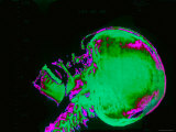 Buy X-Ray Normal Human Skull Head Face Brain Neurology at AllPosters.com