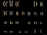 Buy Normal Female Child Karyotype Color at AllPosters.com